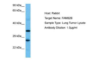 Western Blot: RMD1 Antibody [NBP2-85642] - Host: Rabbit. Target Name: FAM82B. Sample Tissue: Human Lung Tumor lysates. Antibody Dilution: 1ug/ml