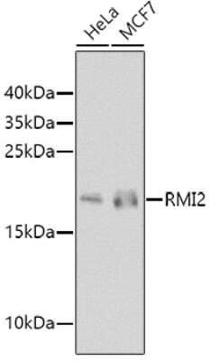 Western Blot: RMI2 Antibody [NBP2-94739] - Analysis of extracts of various cell lines, using RMI2 at 1:1000 dilution. Secondary antibody: HRP Goat Anti-Rabbit IgG (H+L) at 1:10000 dilution. Lysates/proteins: 25ug per lane. Blocking buffer: 3% nonfat dry milk in TBST. Detection: ECL Basic Kit . Exposure time: 90s.