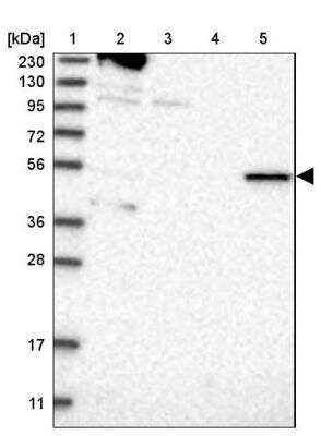 Western Blot: RMND1 Antibody [NBP2-33952] - Lane 1: Marker  [kDa] 230, 130, 95, 72, 56, 36, 28, 17, 11.  Lane 2: Human cell line RT-4.  Lane 3: Human cell line U-251MG sp.  Lane 4: Human plasma (IgG/HSA depleted).  Lane 5: Human liver tissue