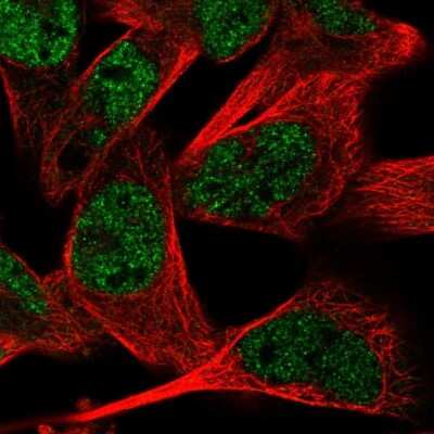 Immunocytochemistry/Immunofluorescence: RMND5A Antibody [NBP2-56367] - Staining of human cell line RH-30 shows localization to nucleoplasm.