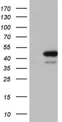 Western Blot: RMND5A Antibody (OTI2C8) - Azide and BSA Free [NBP2-73918] - Analysis of HEK293T cells were transfected with the pCMV6-ENTRY control (Left lane) or pCMV6-ENTRY RMND5A.