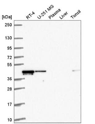 Western Blot: RMND5A Antibody [NBP2-56367] - Analysis in human cell line RT-4, human cell line U-251 MG, human plasma, human liver tissue and human tonsil tissue.