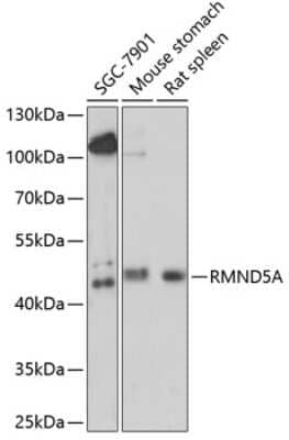 Western Blot: RMND5A Antibody [NBP2-94019] - Analysis of extracts of various cell lines, using RMND5A at 1:1000 dilution. Secondary antibody: HRP Goat Anti-Rabbit IgG (H+L) at 1:10000 dilution. Lysates/proteins: 25ug per lane. Blocking buffer: 3% nonfat dry milk in TBST. Detection: ECL Basic Kit . Exposure time: 90s.