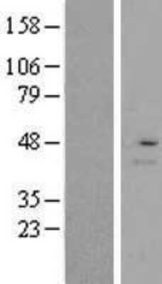 Western Blot: RMND5A Overexpression Lysate (Adult Normal) [NBL1-15389] Left-Empty vector transfected control cell lysate (HEK293 cell lysate); Right -Over-expression Lysate for RMND5A.