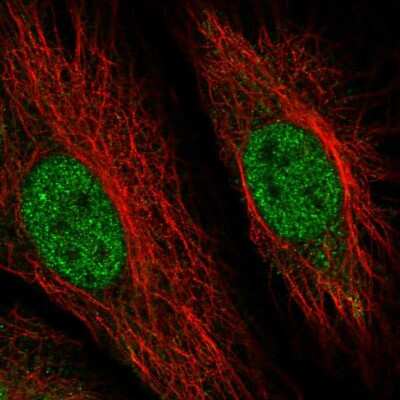 Immunocytochemistry/Immunofluorescence: RMND5B Antibody [NBP2-13234] - Staining of human cell line HeLa shows localization to nucleoplasm. Antibody staining is shown in green.