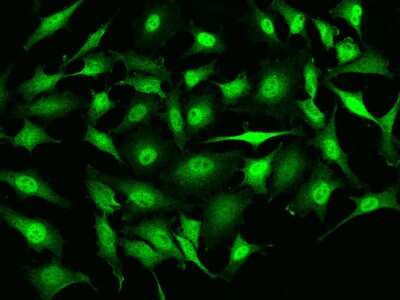 Immunocytochemistry/Immunofluorescence: RMND5B Antibody [NBP2-97633] - Immunofluorescence staining of RMND5B in HeLa cells. Cells were fixed with 4% PFA, permeabilzed with 0.1% Triton X-100 in PBS, blocked with 10% serum, and incubated with rabbit anti-Human RMND5B polyclonal antibody (dilution ratio 1:200) at 4C overnight. Then cells were stained with the Alexa Fluor(R)488-conjugated Goat Anti-rabbit IgG secondary antibody (green). Positive staining was localized to Nucleus and cytoplasm.