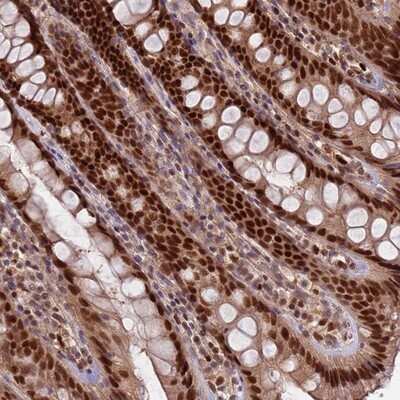 Immunohistochemistry-Paraffin: RMND5B Antibody [NBP2-13234] - Staining of human rectum shows strong nuclear positivity in glandular cells.