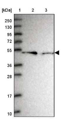 Western Blot: RMND5B Antibody [NBP2-13234] - Lane 1: Marker  [kDa] 250, 130, 95, 72, 55, 36, 28, 17, 10.  Lane 2: Human cell line RT-4.  Lane 3: Human cell line U-251MG sp