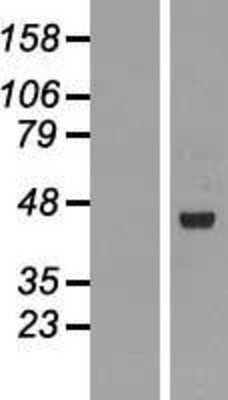 Western Blot: RMND5B Overexpression Lysate (Adult Normal) [NBL1-15390] Left-Empty vector transfected control cell lysate (HEK293 cell lysate); Right -Over-expression Lysate for RMND5B.