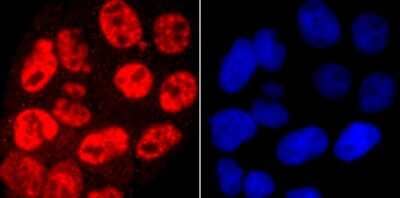 Immunocytochemistry/Immunofluorescence: RNA Polymerase II/POLR2A [ac Ser5] Antibody (JM51-21) [NBP2-66801] - Staining Phospho-POLR2A (S5) in Hela cells (red). The nuclear counter stain is DAPI (blue). Cells were fixed in paraformaldehyde, permeabilised with 0.25% Triton X100/PBS.