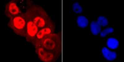 Immunocytochemistry/Immunofluorescence: RNA Polymerase II/POLR2A [ac Ser5] Antibody (JM51-21) [NBP2-66801] - Staining Phospho-POLR2A (S5) in MCF-7 cells (red). The nuclear counter stain is DAPI (blue). Cells were fixed in paraformaldehyde, permeabilised with 0.25% Triton X100/PBS.