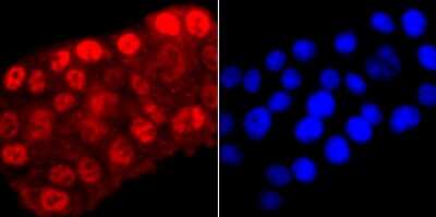 Immunocytochemistry/Immunofluorescence: RNA Polymerase II/POLR2A [ac Ser5] Antibody (JM51-21) [NBP2-66801] - Staining Phospho-POLR2A (S5) in PC-12 cells (red). The nuclear counter stain is DAPI (blue). Cells were fixed in paraformaldehyde, permeabilised with 0.25% Triton X100/PBS.