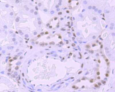 Immunohistochemistry-Paraffin: RNA Polymerase II/POLR2A [ac Ser5] Antibody (JM51-21) [NBP2-66801] - Analysis of paraffin-embedded human kidney tissue using anti- Phospho-POLR2A (S5) antibody. Counter stained with hematoxylin.