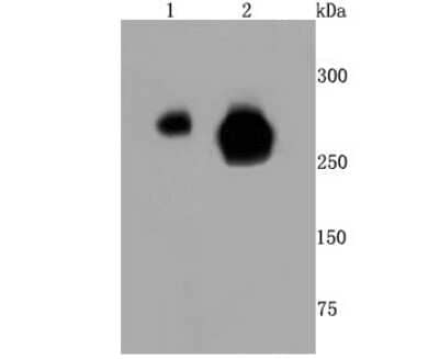 Western Blot: RNA Polymerase II/POLR2A [ac Ser5] Antibody (JM51-21) [NBP2-66801] - Analysis of Phospho-POLR2A (S5) on different cells lysates using anti- Phospho-POLR2A (S5) antibody at 1/500 dilution. Positive control:  Line 1: Hela  Line 2: MCF-7
