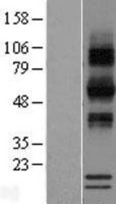 Western Blot: RNASE12 Overexpression Lysate (Adult Normal) [NBP2-08640] Left-Empty vector transfected control cell lysate (HEK293 cell lysate); Right -Over-expression Lysate for RNASE12.