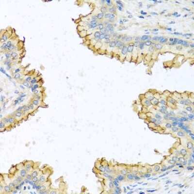 Immunohistochemistry-Paraffin: RNASE13 Antibody [NBP2-94210] - Paraffin-embedded human prostate using RNASE13 .