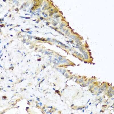 Immunohistochemistry-Paraffin: RNASE13 Antibody [NBP2-94210] - Paraffin-embedded mouse lung using RNASE13 .
