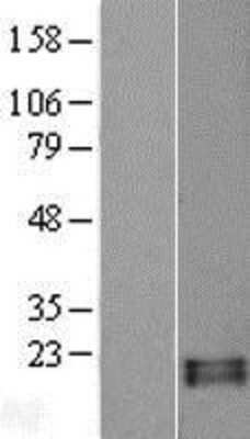 Western Blot: RNASE13 Overexpression Lysate (Adult Normal) [NBL1-15394] Left-Empty vector transfected control cell lysate (HEK293 cell lysate); Right -Over-expression Lysate for RNASE13.