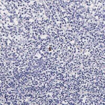 Immunohistochemistry-Paraffin: RNASE6 Antibody [NBP1-80822] - Staining of human tonsil shows strong cytoplasmic positivity in a rare subset of non-germinal center cells.