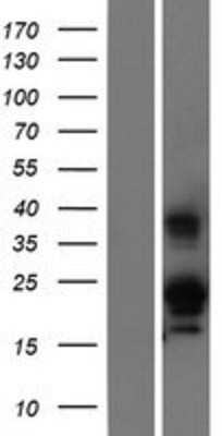 Western Blot: RNASE6 Overexpression Lysate (Adult Normal) [NBP2-07726] Left-Empty vector transfected control cell lysate (HEK293 cell lysate); Right -Over-expression Lysate for RNASE6.