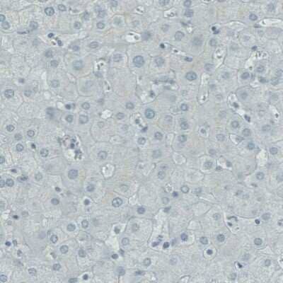 Immunohistochemistry-Paraffin: RNASE7 Antibody (CL0223) [NBP2-52883] - Staining of human liver shows absence of immunoreactivity.