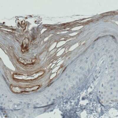 Immunohistochemistry-Paraffin: RNASE7 Antibody (CL0223) [NBP2-52883] - Staining of human skin shows strong immunoreactivity in the outer layer of keratinized squamous epithelium.