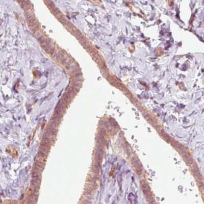 Immunohistochemistry-Paraffin: RNASE7 Antibody (CL0224) [NBP2-52884] - Staining of human fallopian tube shows moderate positivity in glandular cells.