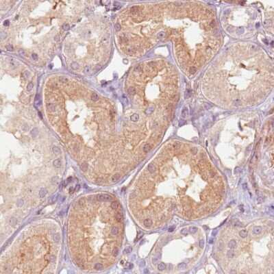 Immunohistochemistry-Paraffin: RNASE7 Antibody (CL0224) [NBP2-52884] - Staining of human kidney shows moderate immunoreactivity in renal tubules.