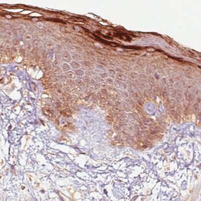 Immunohistochemistry-Paraffin: RNASE7 Antibody (CL0224) [NBP2-52884] - Staining of human skin shows immunoreactivity in keratinocytes, particularly strong in the outer layer.