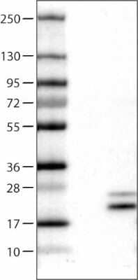 Western Blot: RNASE7 Antibody (CL0224) [NBP2-52884] - Lane 1: Marker [kDa]  Lane 2: Negative control (vector only transfected HEK293T lysate)  Lane 3: Over-expression Lysate (Co-expressed with a C-terminal myc-DDK tag (~3.1 kDa) in mammalian HEK293T cells)