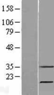 Western Blot: RNASE7 Overexpression Lysate (Adult Normal) [NBP2-05996] Left-Empty vector transfected control cell lysate (HEK293 cell lysate); Right -Over-expression Lysate for RNASE7.