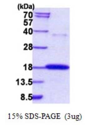 SDS-Page: Recombinant Human RNASE7 Protein [NBP2-22634]