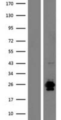 Western Blot: RNASE9 Overexpression Lysate (Adult Normal) [NBP2-09375] Left-Empty vector transfected control cell lysate (HEK293 cell lysate); Right -Over-expression Lysate for RNASE9.