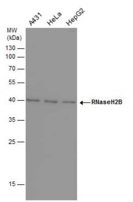 Western Blot: RNASEH2B Antibody (419) [NBP2-43774] - Analysis of various whole cell extracts (30 ug) were separated by 12% SDS-PAGE, and the membrane was blotted with RNaseH2B antibody diluted at a dilution of 1:1000.