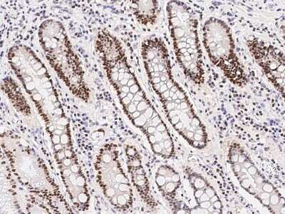 Immunohistochemistry-Paraffin: RNASEH2B Antibody [NBP2-97139] - Immunochemical staining of human RNASEH2B in human stomach with rabbit polyclonal antibody at 1:1000 dilution, formalin-fixed paraffin embedded sections.