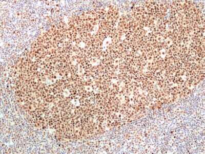 Immunohistochemistry-Paraffin: RNASEH2B Antibody (RM433) [NBP3-09181] - Immunohistochemical staining of formalin fixed and paraffin embedded human tonsil tissue sections using NBP3-09181 at 1:100 dilution.