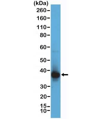 Western Blot RNASEH2B Antibody (RM433)