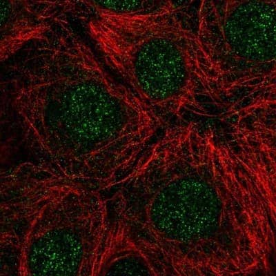 Immunocytochemistry/Immunofluorescence: RNASEH2C Antibody [NBP2-56902] - Staining of human cell line MCF7 shows localization to nucleus.