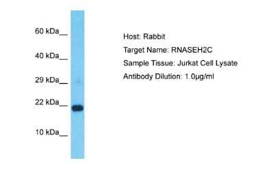 Western Blot: RNASEH2C Antibody [NBP2-85643] - Host: Rabbit. Target Name: RNASEH2C. Sample Type: Jurkat Whole Cell lysates. Antibody Dilution: 1.0ug/ml