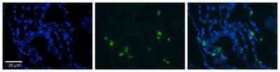 Immunohistochemistry-Paraffin: RNASET2 Antibody [NBP1-80017] - Antibody Formalin Fixed Paraffin Embedded Tissue: Human Lung Tissue  Observed Staining: Cytoplasmic in in alveolar cells, type I and II