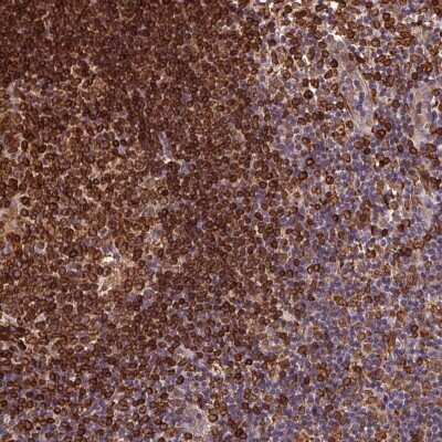 Immunohistochemistry-Paraffin: RNASET2 Antibody [NBP2-49484] - Staining of human lymph node shows strong cytoplasmic positivity in germinal center cells and non-germinal center cells.