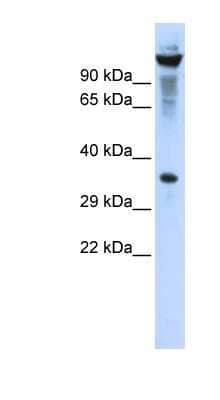 Western Blot: RNASET2 Antibody [NBP1-80017] - 293T cells lysate, concentration 0.2-1 ug/ml.