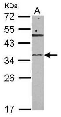 Western Blot: RNASET2 Antibody [NBP2-20173] - Sample (30 ug of whole cell lysate) A: 293T 12% SDS PAGE gel, diluted at 1:500.