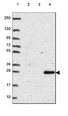 Western Blot RNASET2 Antibody - BSA Free