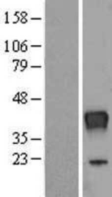 Western Blot: RNASET2 Overexpression Lysate (Adult Normal) [NBP2-07960] Left-Empty vector transfected control cell lysate (HEK293 cell lysate); Right -Over-expression Lysate for RNASET2.