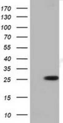 Western Blot: RND1 Antibody (1C3) [NBP2-03000] - HEK293T cells were transfected with the pCMV6-ENTRY control (Left lane) or pCMV6-ENTRY RND1 (Right lane) cDNA for 48 hrs and lysed. Equivalent amounts of cell lysates (5 ug per lane) were separated by SDS-PAGE and immunoblotted with anti-RND1.