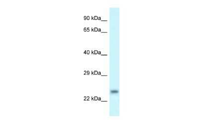 Western Blot: RND1 Antibody [NBP2-88159] - WB Suggested Anti-RND1 Antibody. Titration: 1.0 ug/ml. Positive Control: THP-1 Whole Cell