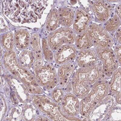 Immunohistochemistry-Paraffin: RND3 Antibody [NBP2-49315] - Staining of human kidney shows moderate membranous and cytoplasmic positivity in cells in tubules.