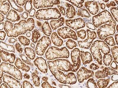 Immunohistochemistry-Paraffin RNF11 Antibody