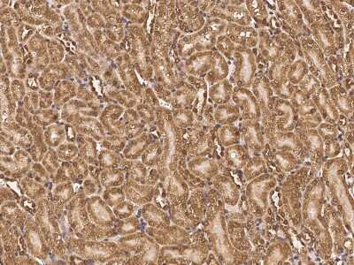 Immunohistochemistry-Paraffin RNF11 Antibody